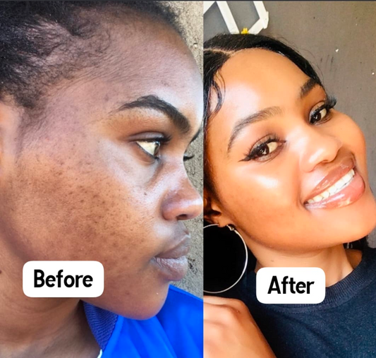 Glow Up Skin Care Body Oil Cosmetic