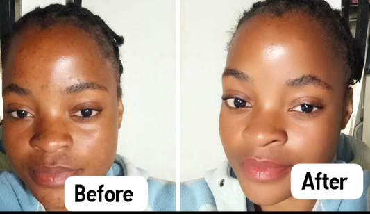 Glow Up Skin Care Brightening Body Oil